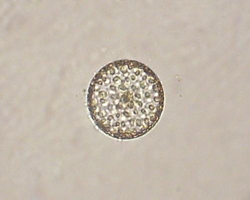 Microalgae (Thalassiosira anguste-lineata)