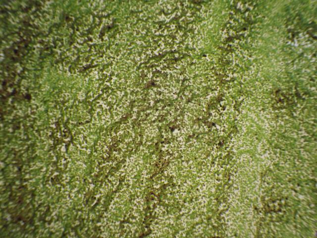 Microalgae (Chlorella ellipsoidea)