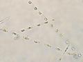Microalgae (Skeletonema costatum)
